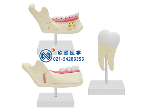 磨牙、乳牙、恒牙模型