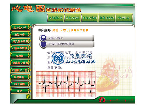 多媒體心電圖教學(xué)與考核軟件